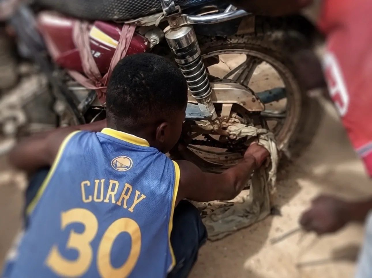 Young Boy Reportedly Loses Part of Right Hand After Motorcycle Wheel Accident