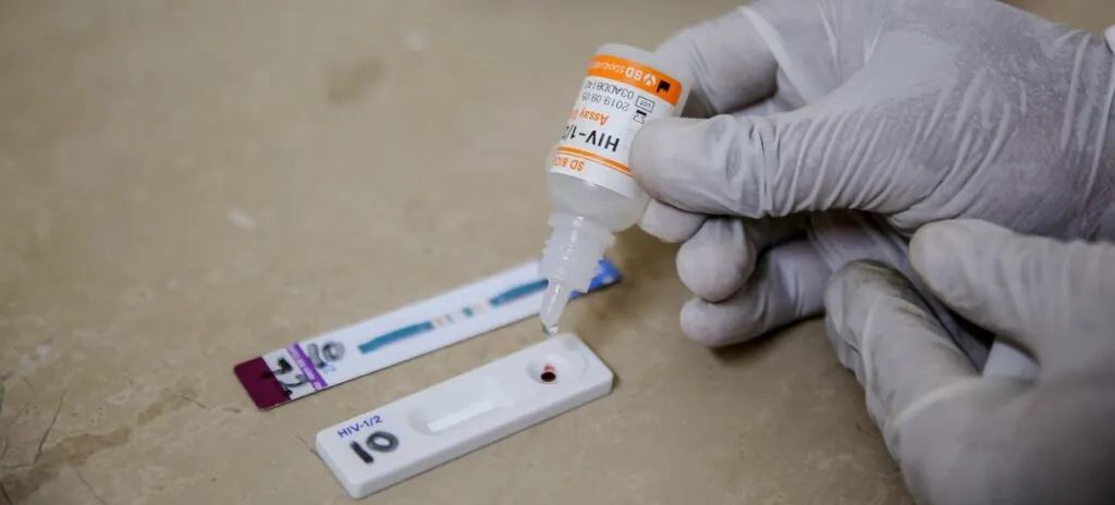 Ghana AIDS Commission confirms ARV stock challenges, expects new supplies in three weeks