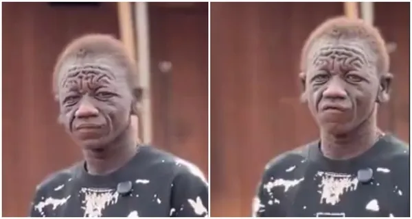'I was denied education because of my face' - Young man recounts painful ordeal