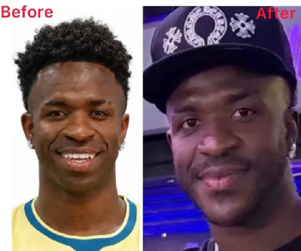 See Vinícius Jr's new look after undergoing chin surgery