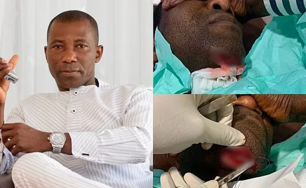Businessman Kenpong hospitalised following serious fall at home